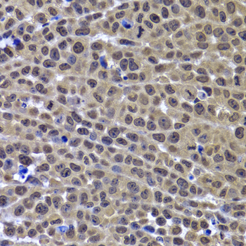 Anti-GPS1 Antibody (CAB6917)