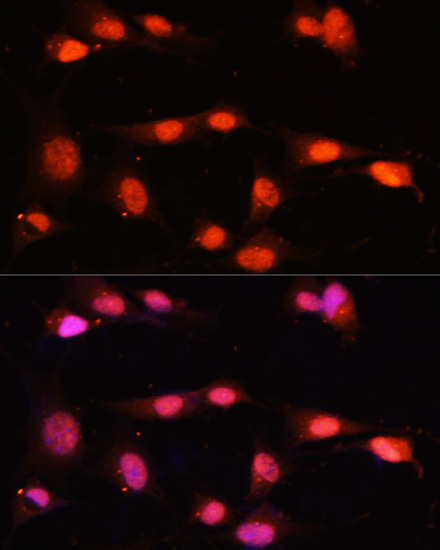 Anti-ZNF264 Antibody (CAB14089)