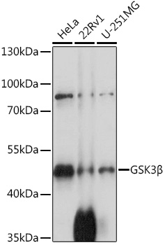 Anti-GSK3Beta Antibody (CAB11578)