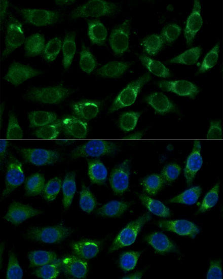 Anti-ALDH3A2 Antibody (CAB16267)