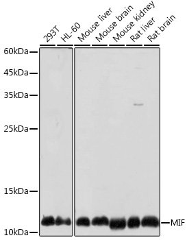 Anti-MIF Antibody (CAB1391)