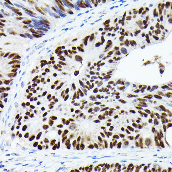 Anti-p53 Antibody (CAB0263)