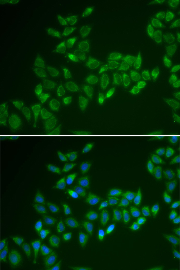 Anti-CRAT Antibody (CAB6365)