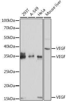 Anti-VEGF Antibody (CAB12303)