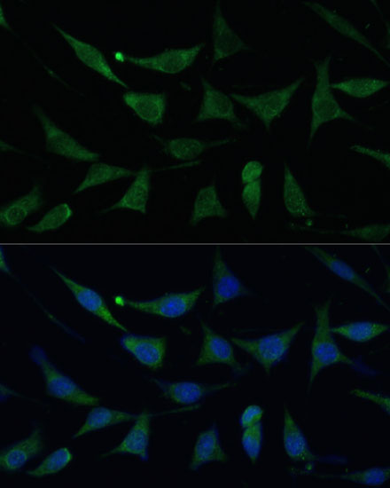 Anti-APLP1 Antibody (CAB6870)