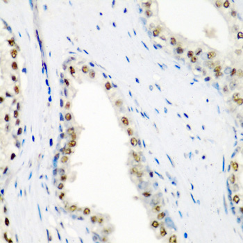 Anti-SF3B3 Antibody (CAB6146)