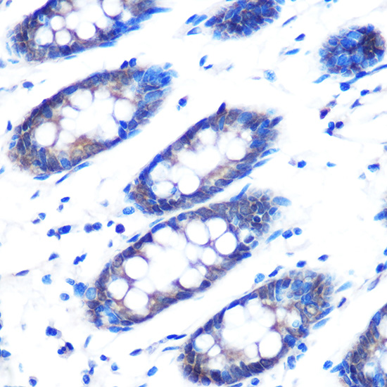 Anti-Rad23B Antibody (CAB1034)