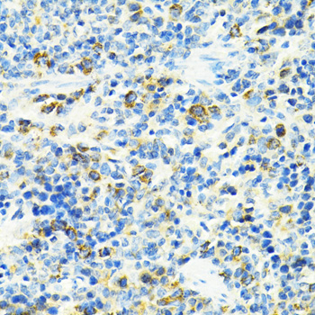 Anti-SLC25A11 Polyclonal Antibody (CAB8163)