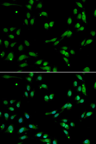 Anti-ANP32A Antibody (CAB5768)