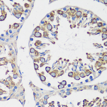 Anti-Cyclin B1 Antibody (CAB16038)