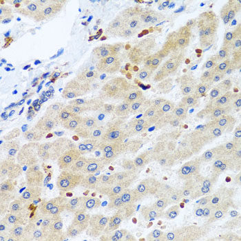 Anti-RGS5 Antibody (CAB7015)