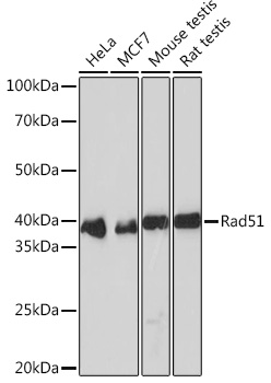 Anti-Rad51 Antibody (CAB2829)