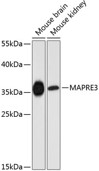 Anti-MAPRE3 Polyclonal Antibody (CAB9591)