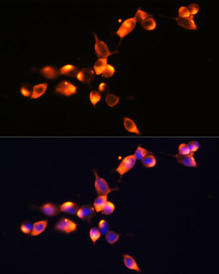 Anti-KLK3 Antibody (CAB2052)