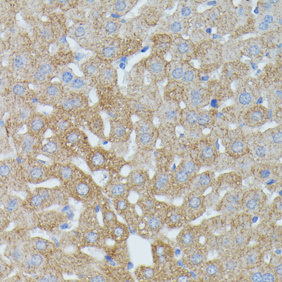 Anti-HP Antibody (CAB1571)