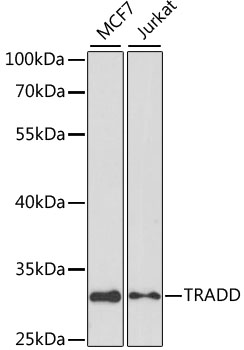 Anti-TRADD Antibody (CAB1145)