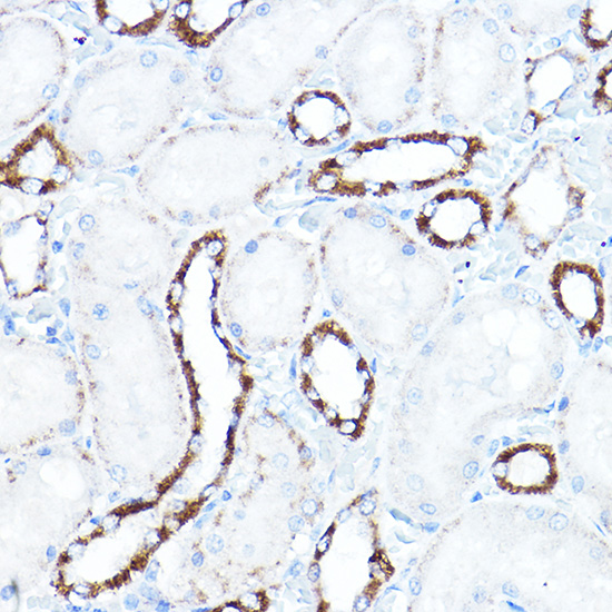 Anti-HK1 Antibody [KO Validated] (CAB1054)