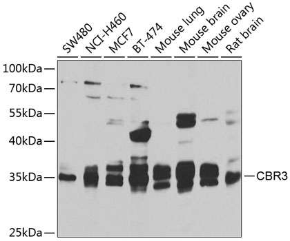 Anti-CBR3 Antibody (CAB7545)