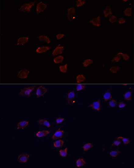 Anti-ARF6 Antibody (CAB0988)