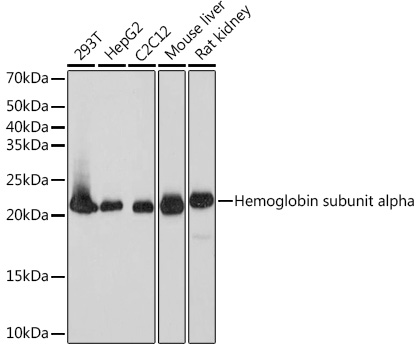 Anti-DHFR Antibody (CAB9299)