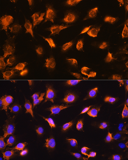 Anti-SGCA Antibody (CAB4109)