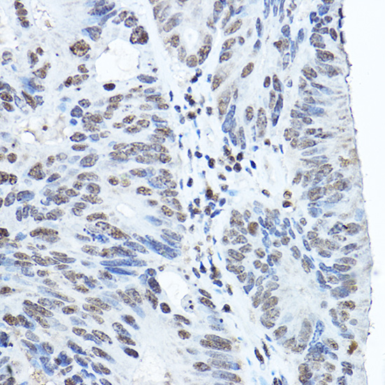 Anti-Twist Antibody (CAB3237)