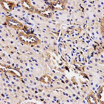 Anti-BCHE Antibody (CAB1460)