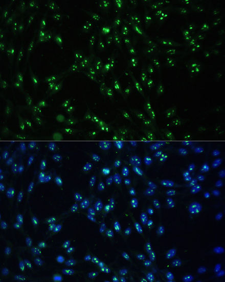 Anti-CCDC59 Antibody (CAB14399)