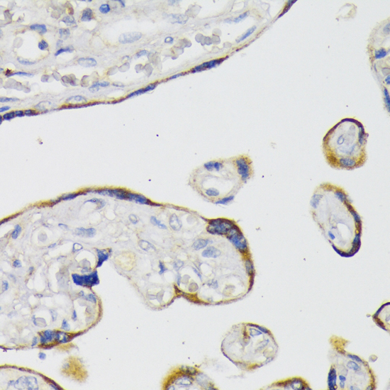 Anti-STAT3 Antibody (CAB11216)