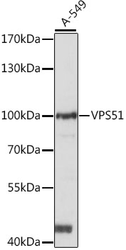 Anti-VPS51 Antibody (CAB15651)