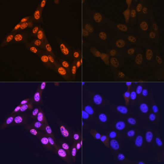 Anti-Phospho-JNK1/2/3-T183/T183/T221 mAb Antibody (CABP0631)