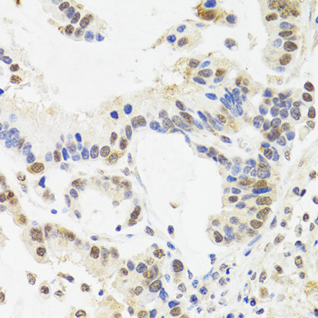 Anti-SUZ12 Antibody [KO Validated] (CAB7786)