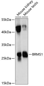 Anti-BRMS1 Antibody (CAB14865)