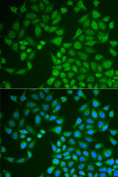 Anti-PNLIP Antibody (CAB6396)