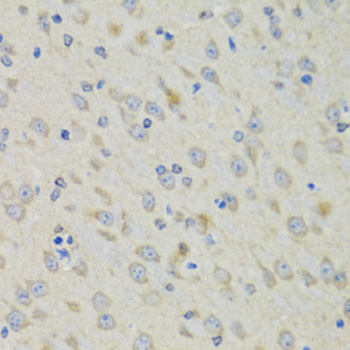 Anti-RAE1 Antibody (CAB6713)