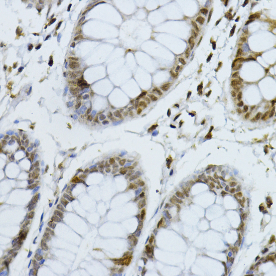 Anti-CDKN1B/p27KIP1 Antibody (CAB16722)