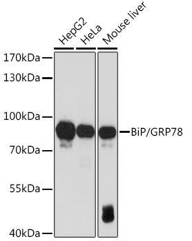 Anti-BiP/GRP78 Antibody (CAB11366)