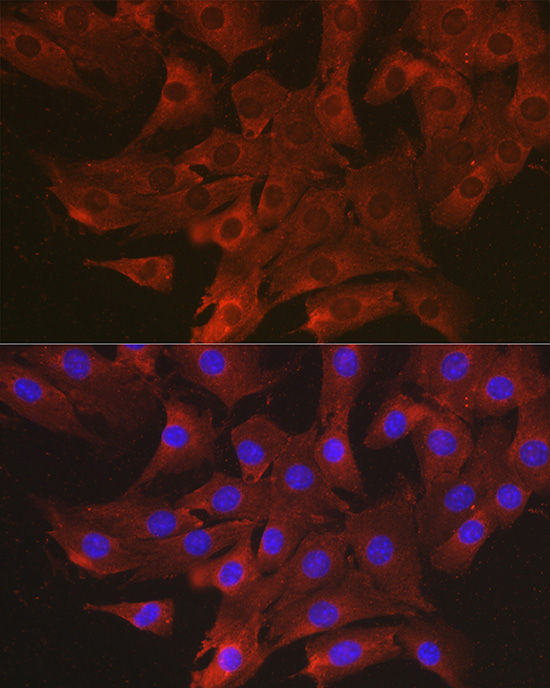 Anti-CCL3 Antibody (CAB7568)