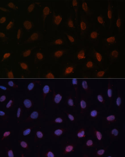 Anti-MED25 Antibody (CAB16150)