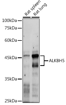 Anti-ALKBH5 Antibody (CAB11684)