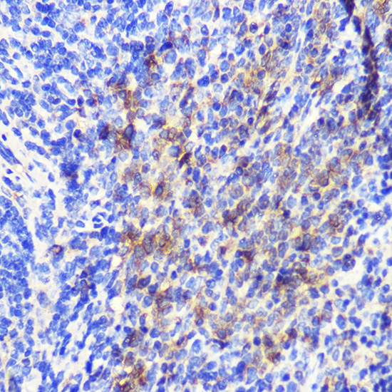 Anti-ATG10 Antibody (CAB7390)