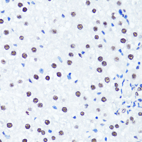 Anti-Symmetric DiMethyl-Histone H3-R2 Antibody (CAB2373)