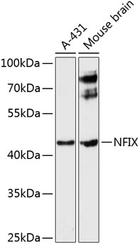 Anti-NFIX Polyclonal Antibody (CAB9390)