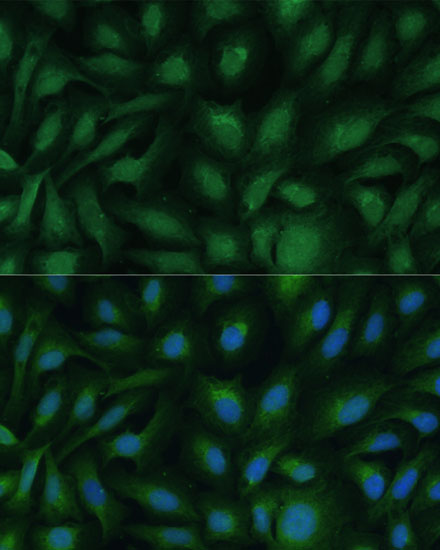 Anti-COG2 Antibody (CAB6251)