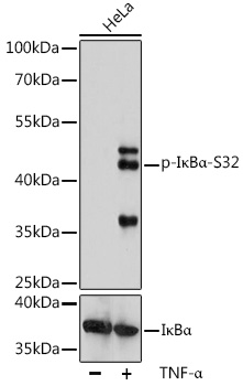 Anti-Phospho-NFKBIA-S32 Antibody (CABP0731)