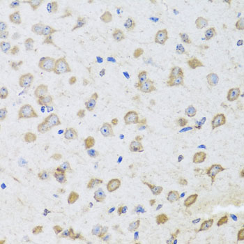 Anti-ARL6 Polyclonal Antibody (CAB8269)