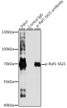 Anti-Phospho-RAF1-S621 Antibody (CABP0087)