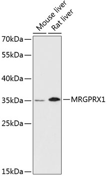 Anti-MRGPRX1 Antibody (CAB13142)