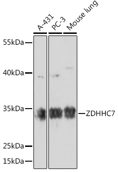 Anti-ZDHHC7 Antibody (CAB17981)