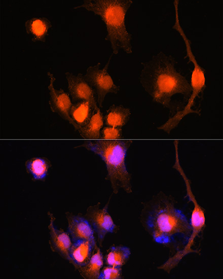 Anti-UCHL1 Antibody (CAB2131)